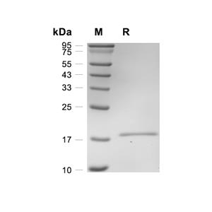 IL-1 beta蛋白, Cynomolgus (His)