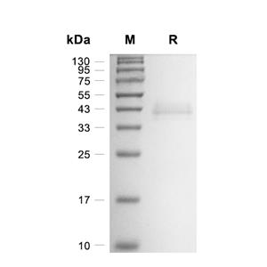 Galectin-4蛋白, Mouse (HEK293, His)