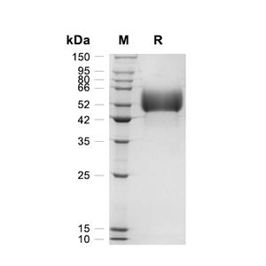 IL-13R alpha 1蛋白, Mouse (HEK293, His),IL-13R alpha 1 Protein, Mouse (HEK293, His)