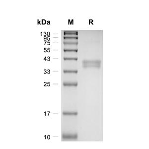 IgG2B Fc蛋白, Llama (HEK293)