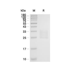 Frizzled-7蛋白, Human (HEK293, His)