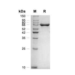 Serum Albumin/ALB蛋白, Rabbit (HEK293, His)