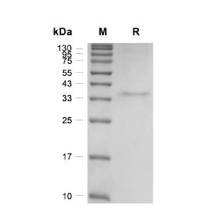 JAK1蛋白, Human (sf9, His)