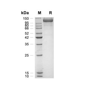 CEACAM5蛋白, Mouse (HEK293, His)