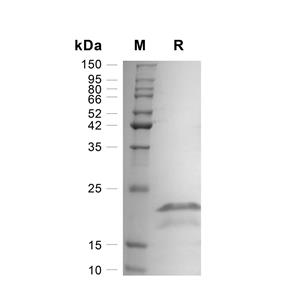 TRAIL/TNFSF10蛋白, Mouse (His),TRAIL/TNFSF10 Protein, Mouse (His)