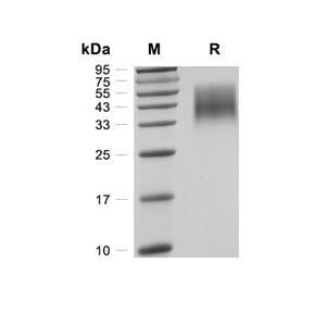 IL-4R alpha蛋白, Canine (HEK293, His)