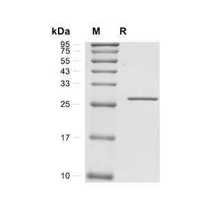 Tenascin/Tnc蛋白, Mouse (HEK293, His-Myc),Tenascin/Tnc Protein, Mouse (HEK293, His-Myc)