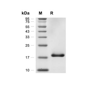 FGF basic/bFGF蛋白, Human (145a.a, His)