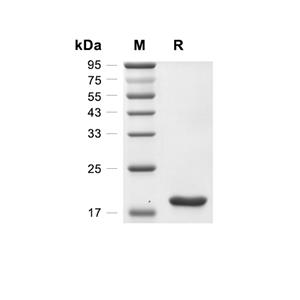 IL-22蛋白, Mouse (His)