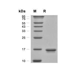IL-2蛋白, Human (His)