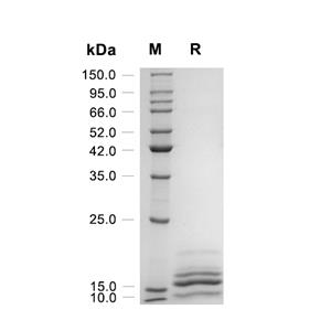 IL-17A蛋白, Rat (CHO)