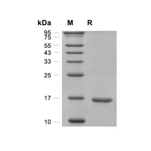 RBP7蛋白, Human (His)