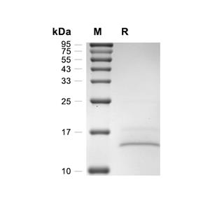 PSP94/MSMB蛋白, Human (His)