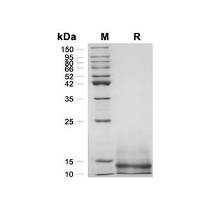 IL-8/CXCL8蛋白, Porcine,IL-8/CXCL8 Protein, Porcine