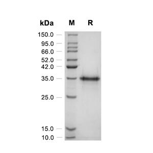 Osteopontin/OPN蛋白, Rat (CHO, His)