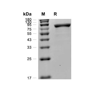 O-GlcNAcase/OGA蛋白, B. thetaiotaomicron (His)
