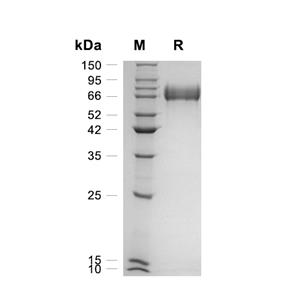 Acetylcholinesterase/ACHE蛋白, Human (CHO, His)