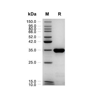 PPA1蛋白, S. cerevisiae (His)
