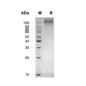 Agrin蛋白, Human (1073a.a, CHO, His)