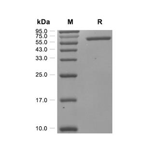 BTNL8蛋白, Human (HEK293, hFc),BTNL8 Protein, Human (HEK293, hFc)