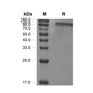 Calcium-sensing R/CaSR蛋白, Human (HEK293, His)
