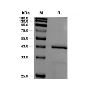 Ataxin-3蛋白, Human (His)