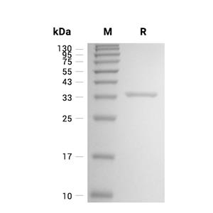 QPCT蛋白, Mouse (His)