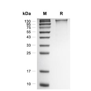 MERS-CoV Spike/S1蛋白 (CHO, hFc)