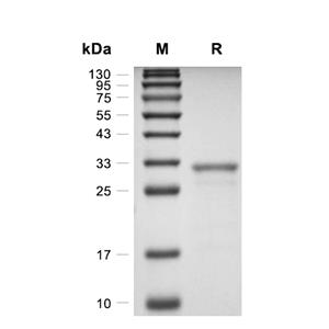 Galectin-3/LGALS3蛋白, Mouse