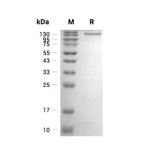 Jagged-2/JAG2蛋白, Human (CHO, hFc),Jagged-2/JAG2 Protein, Human (CHO, hFc)