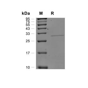 MMP-16蛋白, Human (I152N, His)