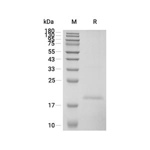 MD-2/LY96蛋白, Human (His)