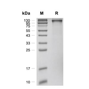 Siglec-11蛋白, Human (E84A, K145Q, CHO, hFc),Siglec-11 Protein, Human (E84A, K145Q, CHO, hFc)