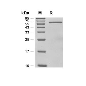 Toxin B/TcdB蛋白, C. difficile (His),Toxin B/TcdB Protein, C. difficile (His)