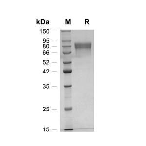 Furin/PCSK3蛋白, Mouse (HEK293, His)