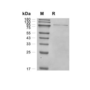 Chondroitinase ABC蛋白, P. vulgaris (His)