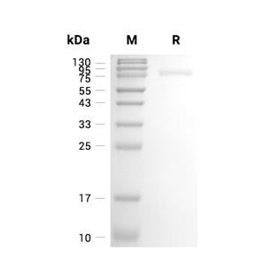 Heparanase/HPSE蛋白, Human (CHO, His),Heparanase/HPSE Protein, Human (CHO, His)