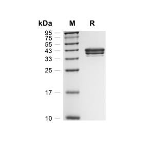 Notum蛋白, Human (C330S, CHO, His)