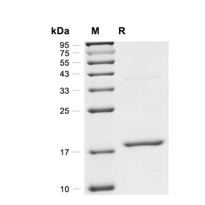 UbcH7/UBE2L3蛋白, Human,UbcH7/UBE2L3 Protein, Human