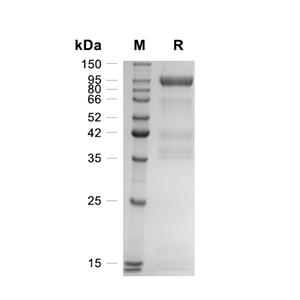 Lgr5/GPR49蛋白, Human (CHO, hFc)