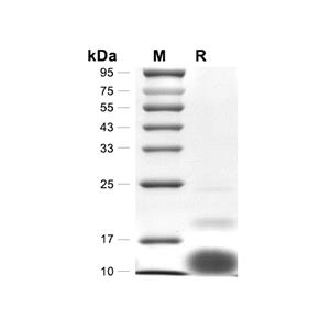 TMSB4X/Thymosin beta 4蛋白, Human (His),TMSB4X/Thymosin beta 4 Protein, Human (His)