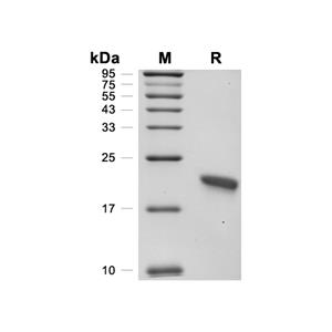 ARMET/MANF蛋白, Human (His)