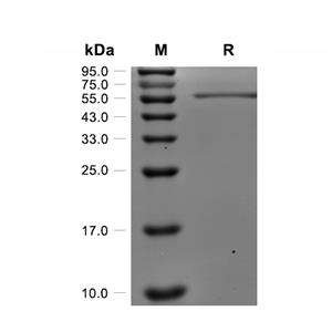 FGF-9蛋白, Human (HEK293, N-hFc)