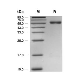 Legumain蛋白, Mouse (HEK293, C-His),Legumain Protein, Mouse (HEK293, C-His)