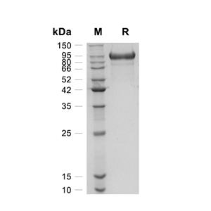 MMP-9蛋白, Mouse (HEK293, C-His)