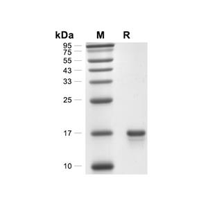 IL-3蛋白, Rhesus macaque (His)