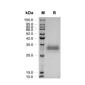 SARS-CoV-2 S蛋白 RBD (194a.a, HEK293, C-His)