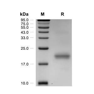 AG-2蛋白, Human (HEK293, His)