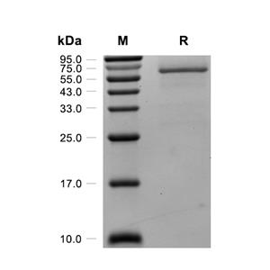 Arylsulfatase A/ARSA蛋白, Human (HEK293, His)