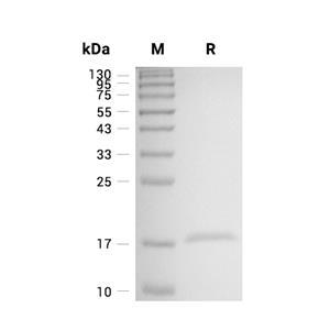 Staphylokinase蛋白, Staphylococcus phage (His),Staphylokinase Protein, Staphylococcus phage (His)